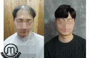 커넥트 고정식 시술 고객님